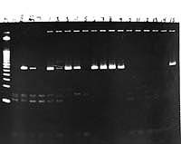 Adenovirus PCR electrophoresis gel