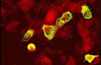Adenovirus shell vial culture