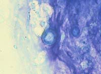 Acanthamoebae cyst