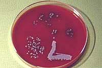 S.aureus on 5% blood agar plate