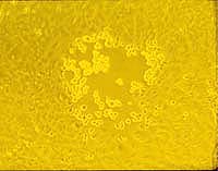 Viral CPE