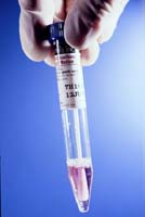 Bartels Chlamydia transport media