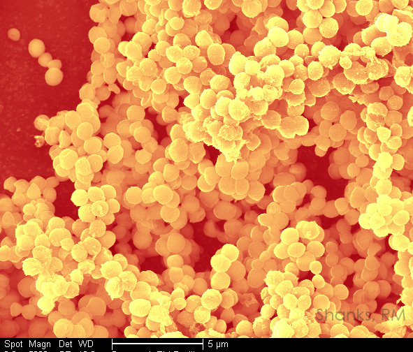SEM of Staphylococcus aureus