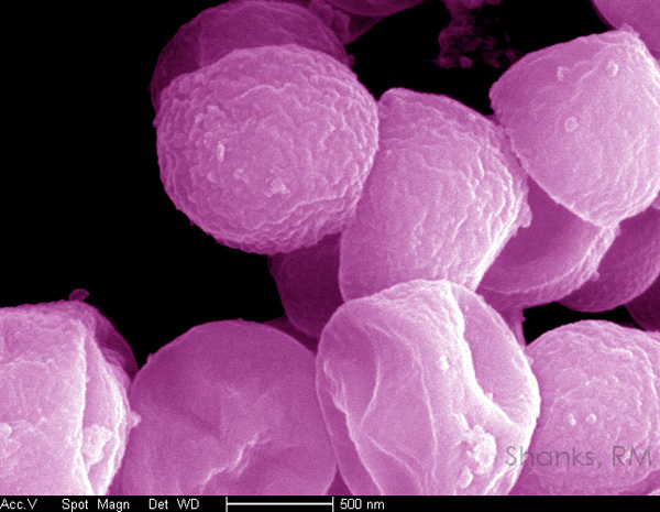 SEM of Staphylococcus aureus