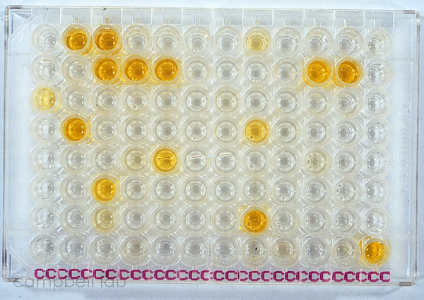 Chlamydia PCR