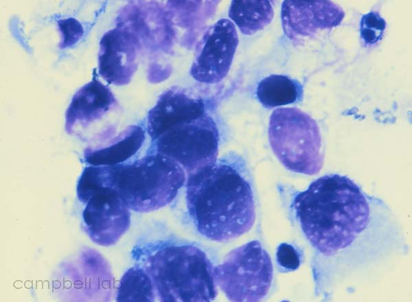 Cytology Photo Gallery